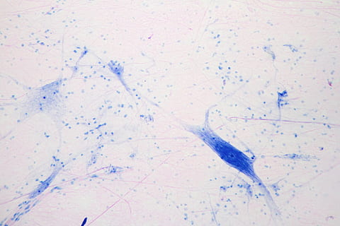 microscope view, giant multipolar neuron, multipolar, neuron, axon, dendrites, central, nervous, system, biology, science, research, education, college, university, cell, body, nucleus, medicine, medical, structure, nerve, colored, blue, microscope, enlarged, big, backgrounds, no people, full frame, indoors, pattern, ink, paper, water, architecture, close-up, textured, nature, abstract, art and craft, creativity, tiled floor, 2K, CC0, public domain, royalty free