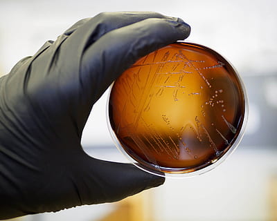 food safety pathogen, listeria, monocytogenes, isolated, agar, sample., analysis, bacteria, bacteriology, biotechnology, culture, health, inspection, lab, laboratory, medical, medicine, microbiology, microorganism, petri, dish, plate, sample, science, technology, test, research, experiment, experimental, safety, risk, danger, water, quality, fungi, disease, sickness, germs, hygience, scientific, colonies, bacterium, discovery, healthcare, toxin, toxic, organism, media, cells, life, college, examination, growth, molecular, hazard, sanitation, haccp, microbial, food, human hand, holding, human body part, one person, close-up, hand, sphere, globe - man made object, indoors, nature, focus on foreground, drop, education, environment, glass - material, biology, 1080P, CC0, public domain, royalty free