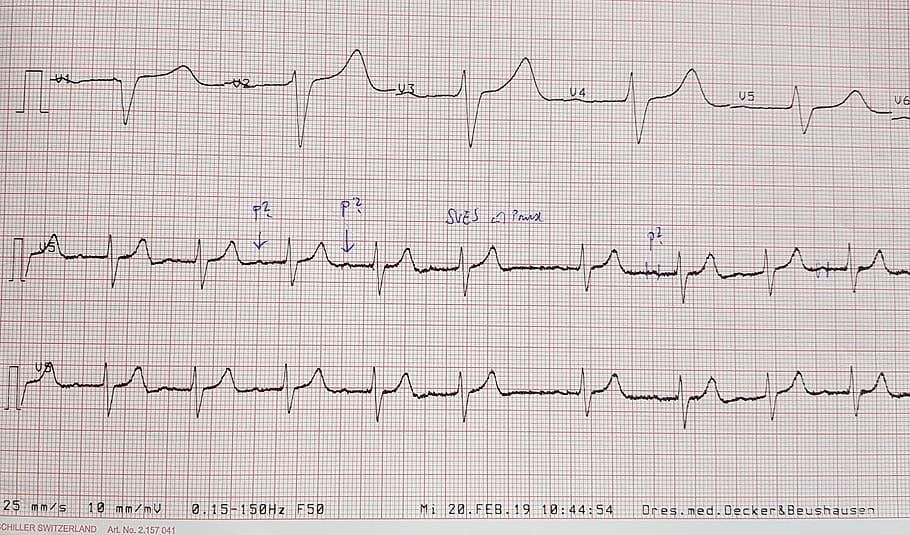 ecg, gràfic, investigació, cor, nota, la oficina del doctor, marc complet, comunicació, traça de pols, fons, escriptura a mà, cap gent, salut i medicina, paper, ciència, tecnologia, text, a l'interior, patró, guió occidental, primer pla, instrument de mesura, missatge, document, 2K
