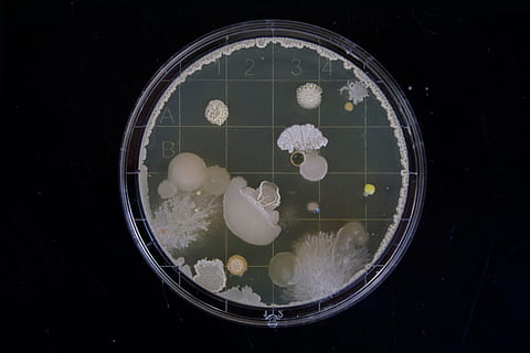 scope image, cell, mold, science, bacteria, grid, microscope, slide, organism, close up, detail, sample, closeup, micro, macro, bacterium, indoors, no people, close-up, studio shot, directly above, circle, shape, geometric shape, freshness, glass - material, flower, water, still life, food and drink, transparent, high angle view, nature, wellbeing, food, black background, floating on water, 5K, CC0, public domain, royalty free
