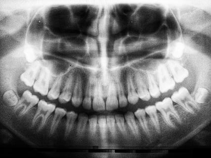 teeth x-ray, one person, human body part, close-up, front view, indoors, body part, real people, human hand, hand, reflection, portrait, adult, multiple exposure, lifestyles, digital composite, x-ray image, human face, selective focus, looking at camera, finger, 4K, CC0, public domain, royalty free