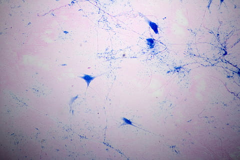 microscope view, giant multipolar neuron, multipolar, neuron, axon, dendrites, central, nervous, system, biology, science, research, education, college, university, cell, body, nucleus, medicine, medical, structure, nerve, colored, blue, microscope, enlarged, big, backgrounds, no people, textured, pattern, full frame, paper, splattered, architecture, stained, multi colored, close-up, old, built structure, indoors, abstract, dirt, water, wall - building feature, messy, blob, 2K, CC0, public domain, royalty free